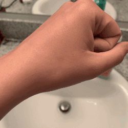 Just Nutritive Skin Care Review | Does Just Nutritive Really Work? 4 before and after